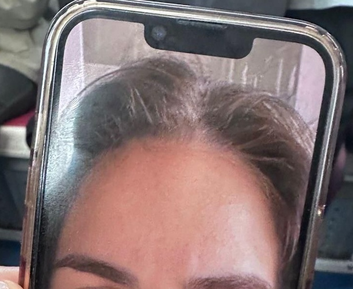 Crop after